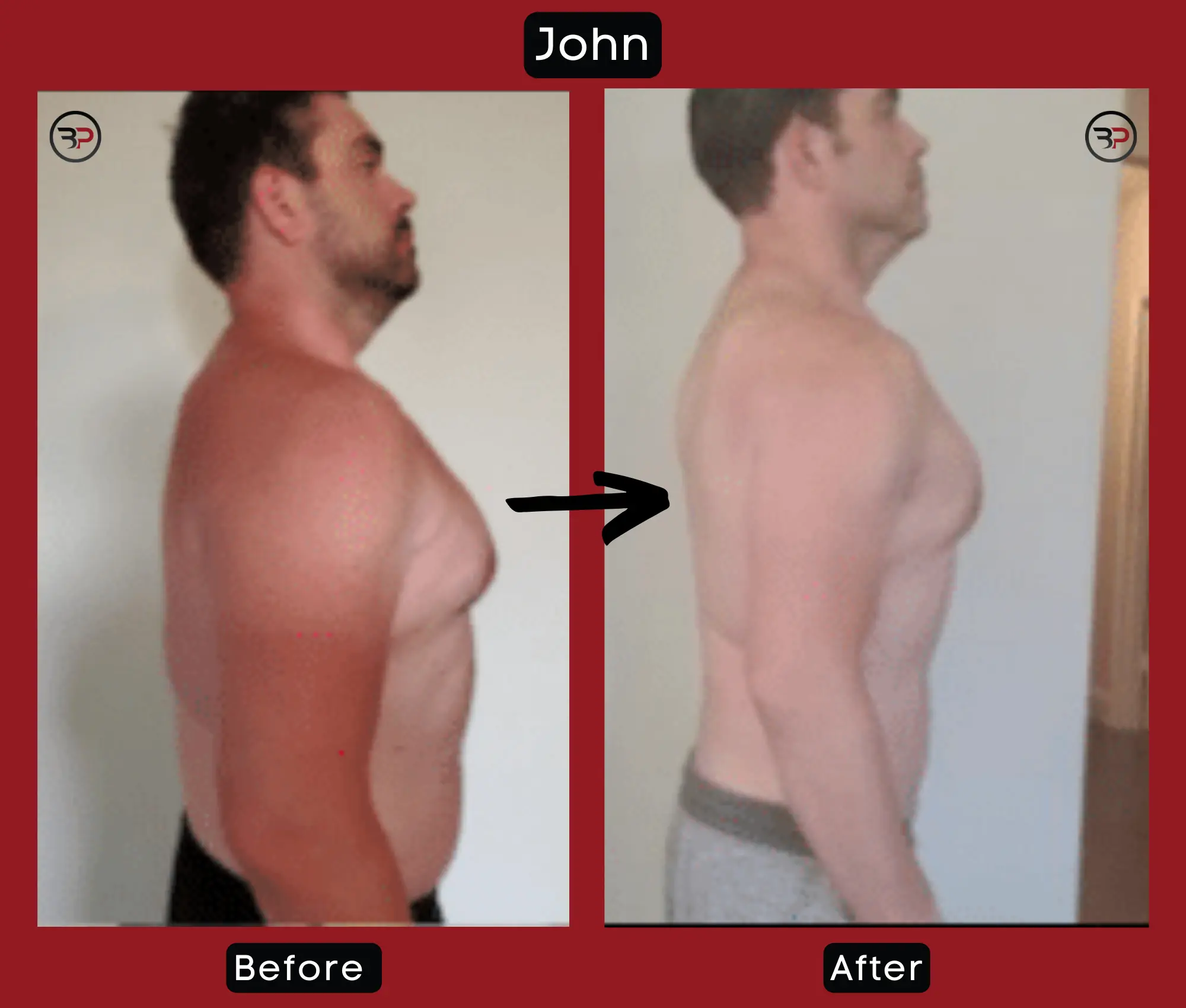 BP Before After – John